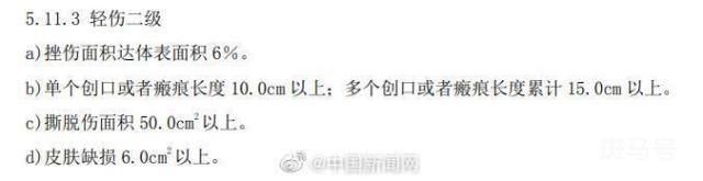 什么是轻伤二级?评定标准来了(图12) 什么是轻伤二级?评定标准来了(图12)